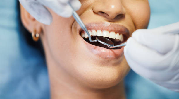Best Dental Abscess Treatment in Montebello, NY